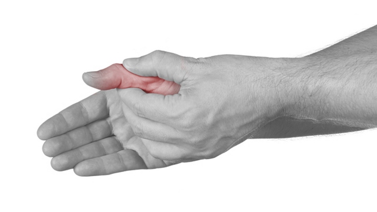 skauda sąnarį ant šepečio rankų gydymo rankų skausmas gydymas namuose