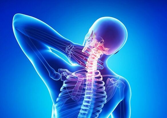 dugootroschatyh artrito sąnarius apatinėje nugaros kaip pašalinti sąnarių uždegimas artrozės metu