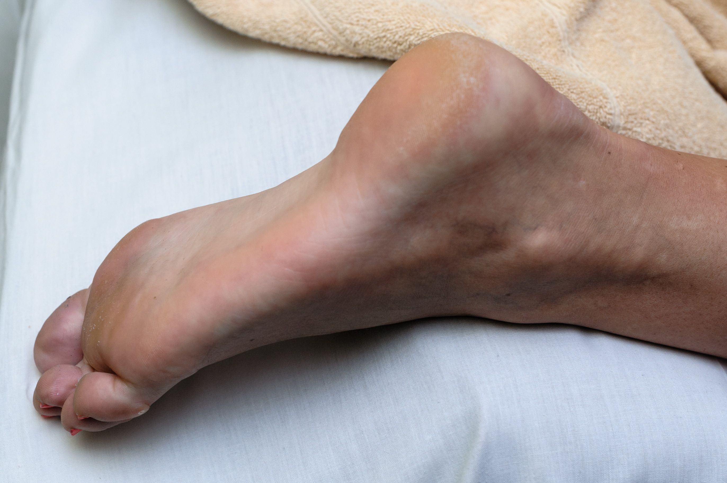 anti-juodmedis mazi sąnarių skausmas nykščio rankų priežastis ir gydymo sąnario