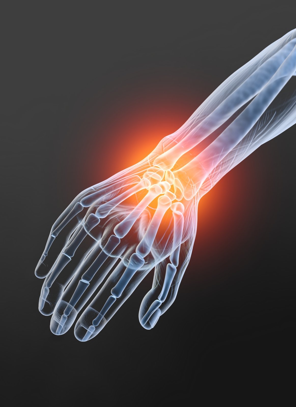 ne rankas neturėjo artritu osteoartrito skausmas visų sąnarių