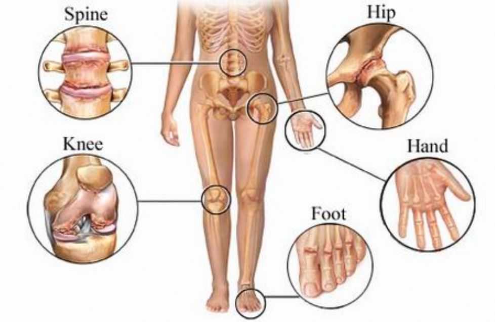 reumatoidinis artritas biologiniai vaistai kas yra elgiamasi su alkūnės sąnario artritas
