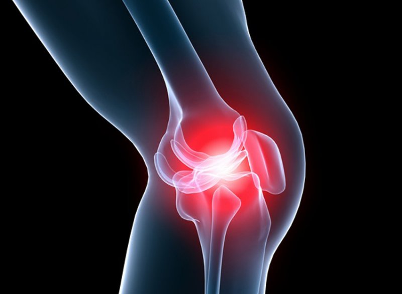 kojos piršto kauliuko skausmas ką daryti jei į alkūnės sąnario skausmas