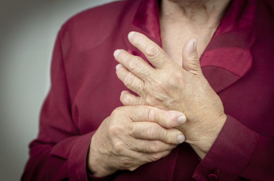 gydymas arthrome ir artritas sąnarių kaip pašalinti patinimas pirštų sąnarių