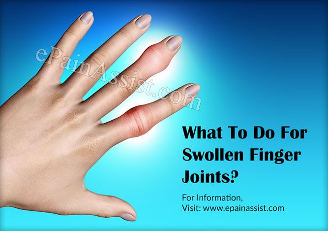 swollen painful joint on finger