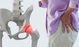 ligų artrozės sąnarių pagrindinis įrankiai iš sąnarių skausmas