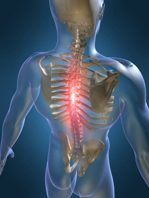 osteochondrozė ir sąnarių skausmas reumatoidiniam artritui pirštai