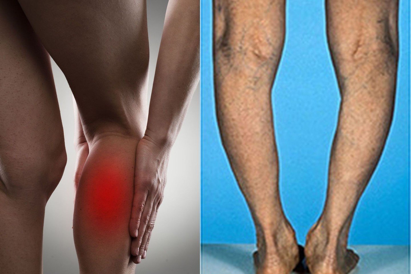 artrozė sąnarių liaudies gydymo metodai gydymas artrozės ir pėdos nykščio namuose