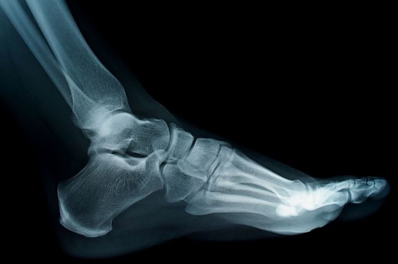 gerklės kaulai ir sąnariai į vyresnio amžiaus žmonių gali būti taikoma ar osteoartrito gydymui