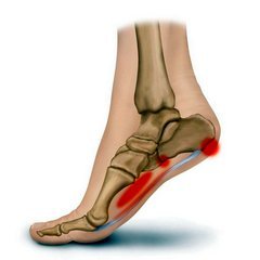 skausmas pėdos pėdos po traumos