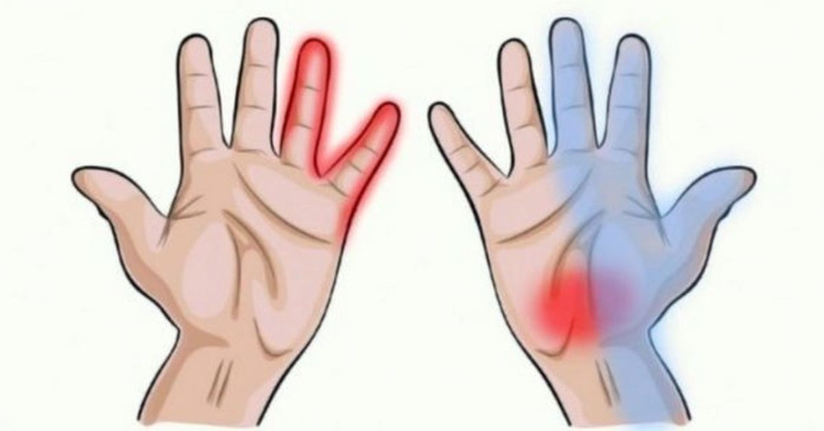 artritas rankų liaudies gydymas tabletės pagal pečių artrozės