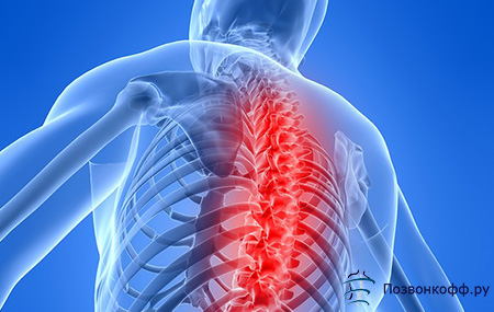 liaudies gynimo priemonės nuo nugaros skausmų osteochondrozės metu