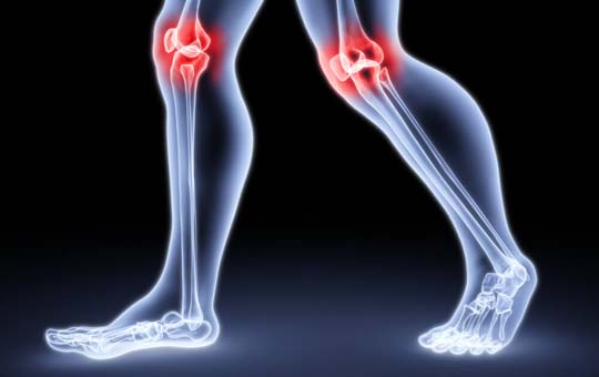 artrozė jungtiniame artritas sustav pėdų sukelia gydymas