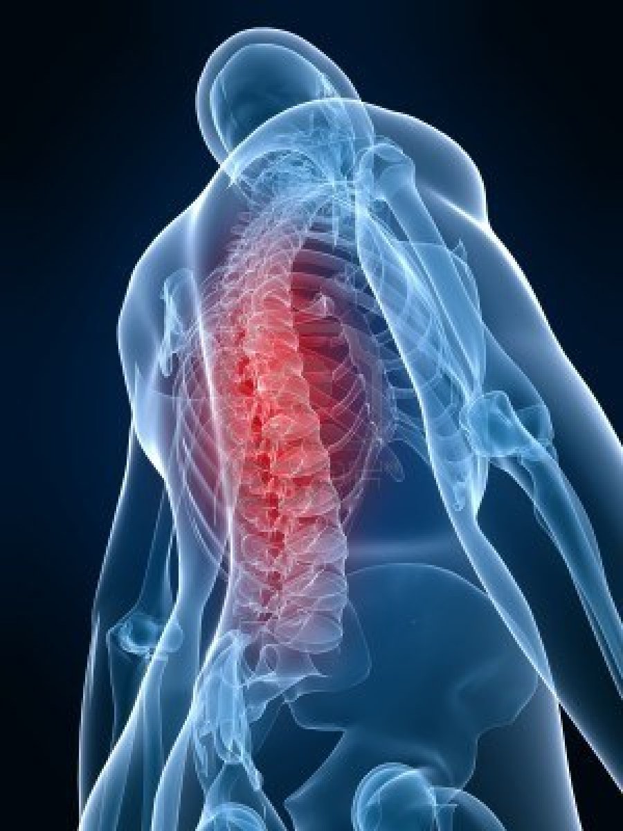 sąnarių skausmas ir nugaros su plokščiapėdiškumas
