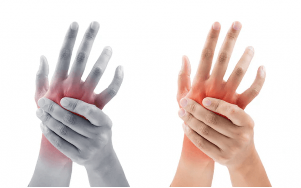 reumatoidinis artritas tirpimo pirštai delagil už sąnarių skausmas