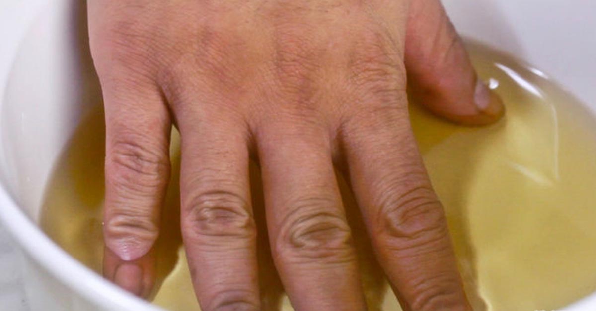 skausmas ir rankų sąnarių uždegimas skauda sąnarius ant rankų pirštų ką daryti