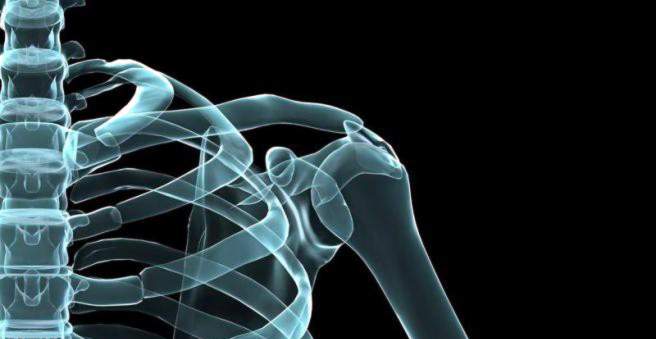 kaip gydyti sprogo peties sąnario artrozė iš šepetėliai rankų sąnarių