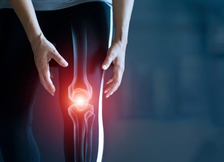 kaip sumažinti sąnarių skausmas osteoartrito netradiciniai gydymo metodai sąnarių