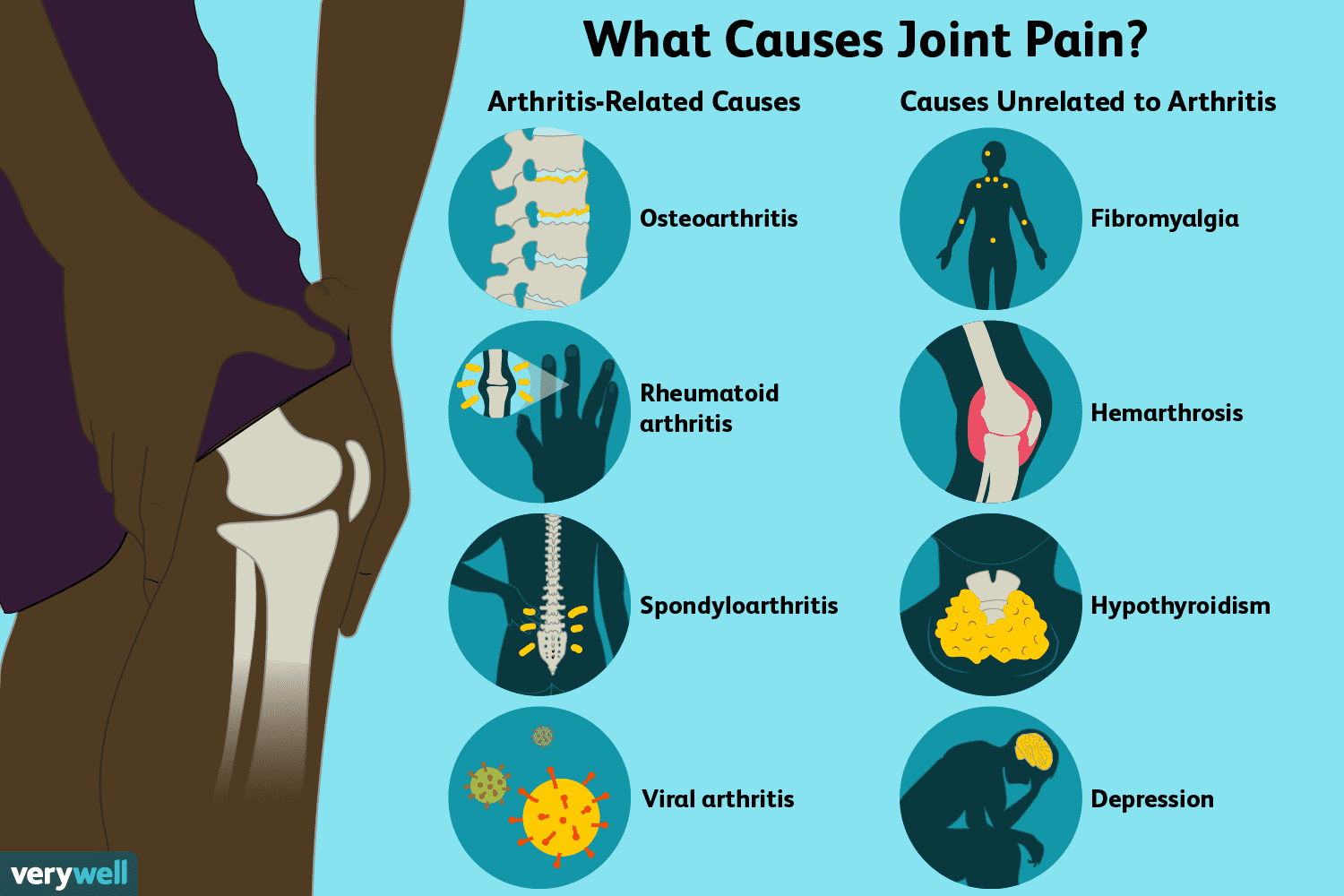 painful swollen joints and muscles dviračių už artrozės gydymo