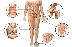 swelling bone joints kairės rankos peties skausmas