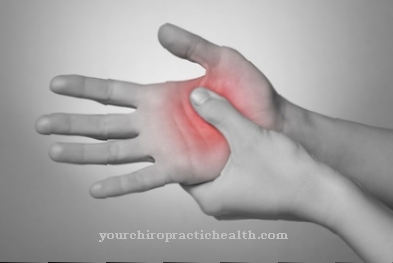 rankos opos periodiškai skausmas sąnarių ir raumenų