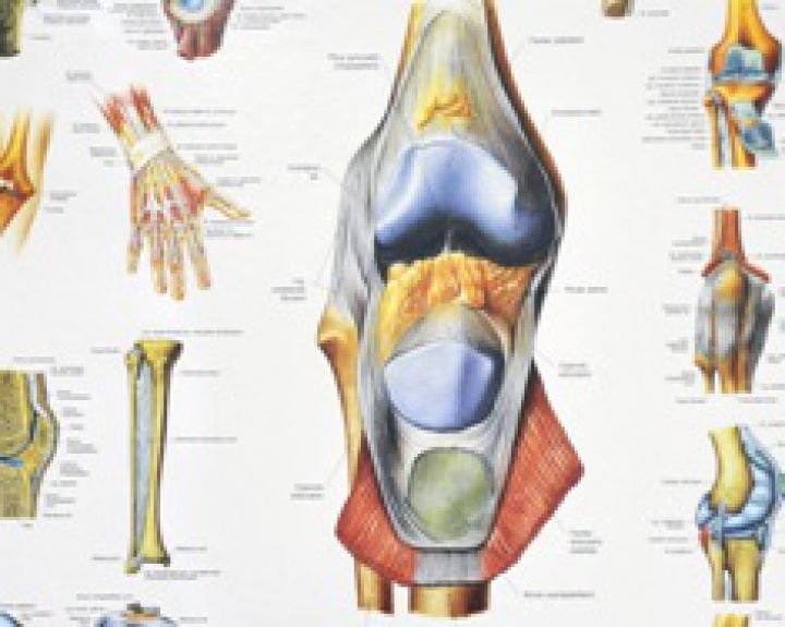 skausmas pėdos pėdos liko reumatoidinio artrito faktorius