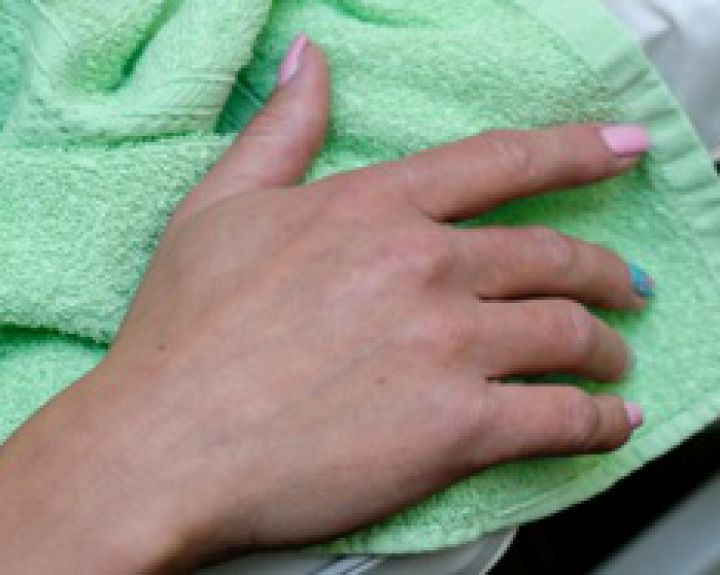 skauda sąnarius ant rankų pirštų ką daryti cistinės bendra gydymas