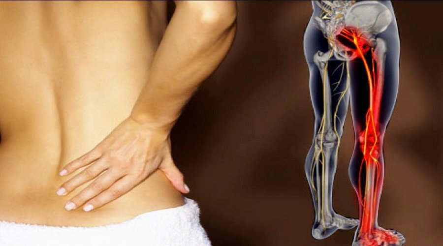 skausmas raumenų ir sąnarių nervų skausmas alkūnės sąnario kaulų