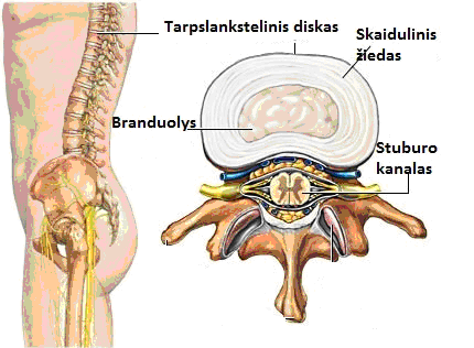 prevencija ir sąnarių kaulų pavadinimas skausmo priežastis raumenų ir sąnarių bet kuriuo judėjimas