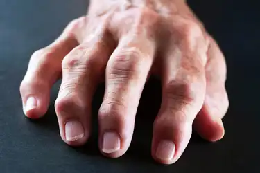artritas rankų liaudies gydymas