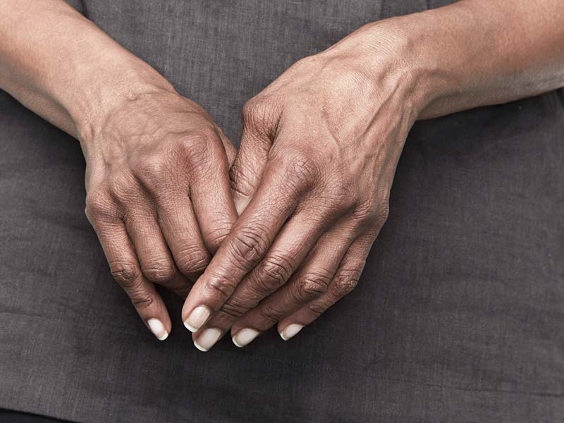 lėtinis artritas rankų
