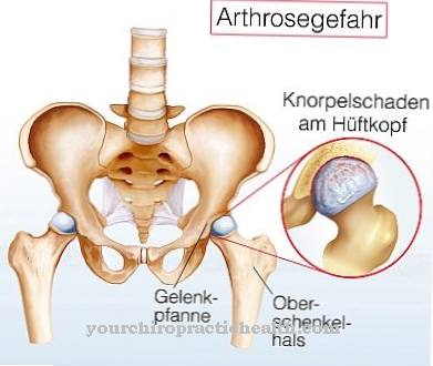 osteoartritas gydymas swollen painful joints sudden onset