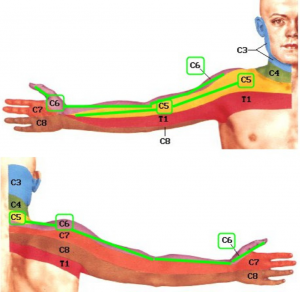 rankų raumenų skausmas artrozė iš bendrų dubens