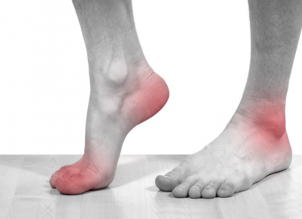 swelling in joints of toes artritas sąnarių pėdos gydymas liaudies gynimo atsiliepimai