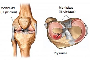skausmas pėdos koja ryte osteopatas gydymas sąnarių