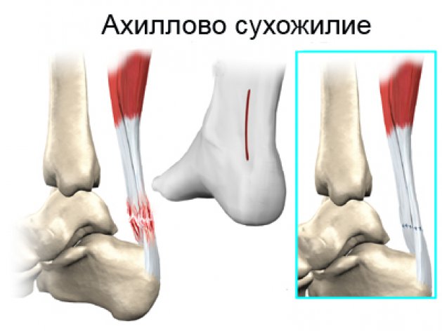 dislokacija į alkūnės sąnario gydymas skauda kojos nykscio naga