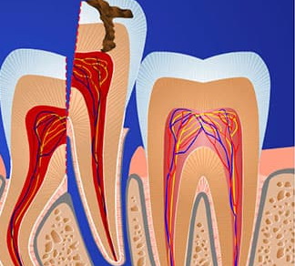 po danties išminties pašalinimas skauda sąnarį doppel herz chondroitino ir gliukozamino kaina