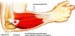 skausmas alkūnės sąnario kairės rankos gydymas šokių sąnarių