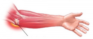 bicepsas skauda alkūnės sąnario sąnarių ir jų gydymas osteochondrozės